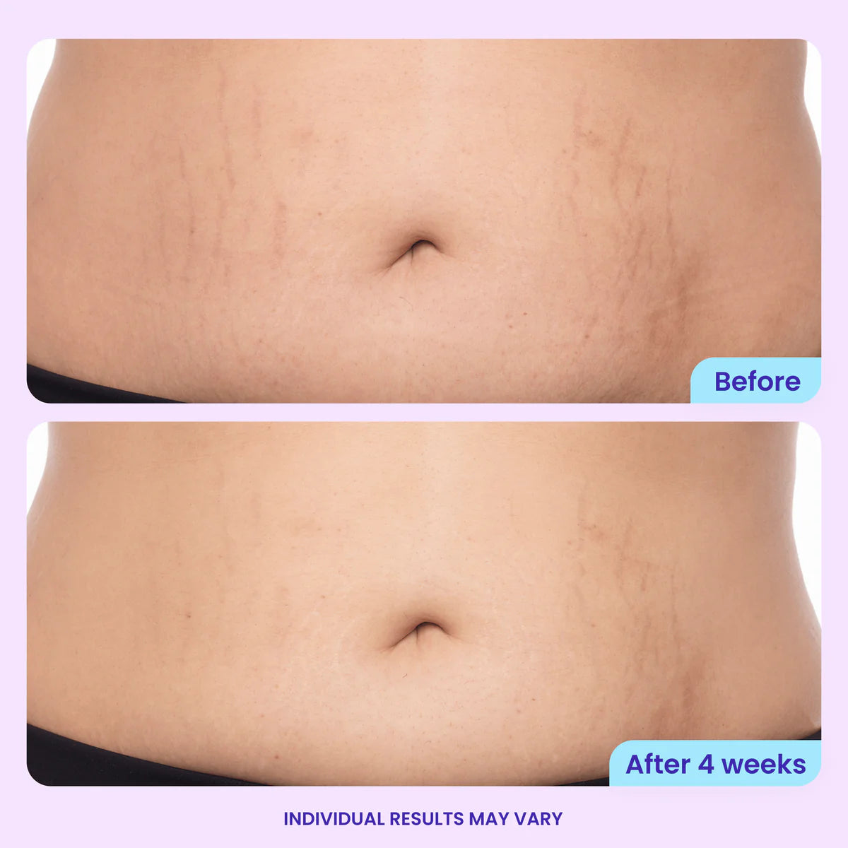 Firmagen™ Belly Firming Cream