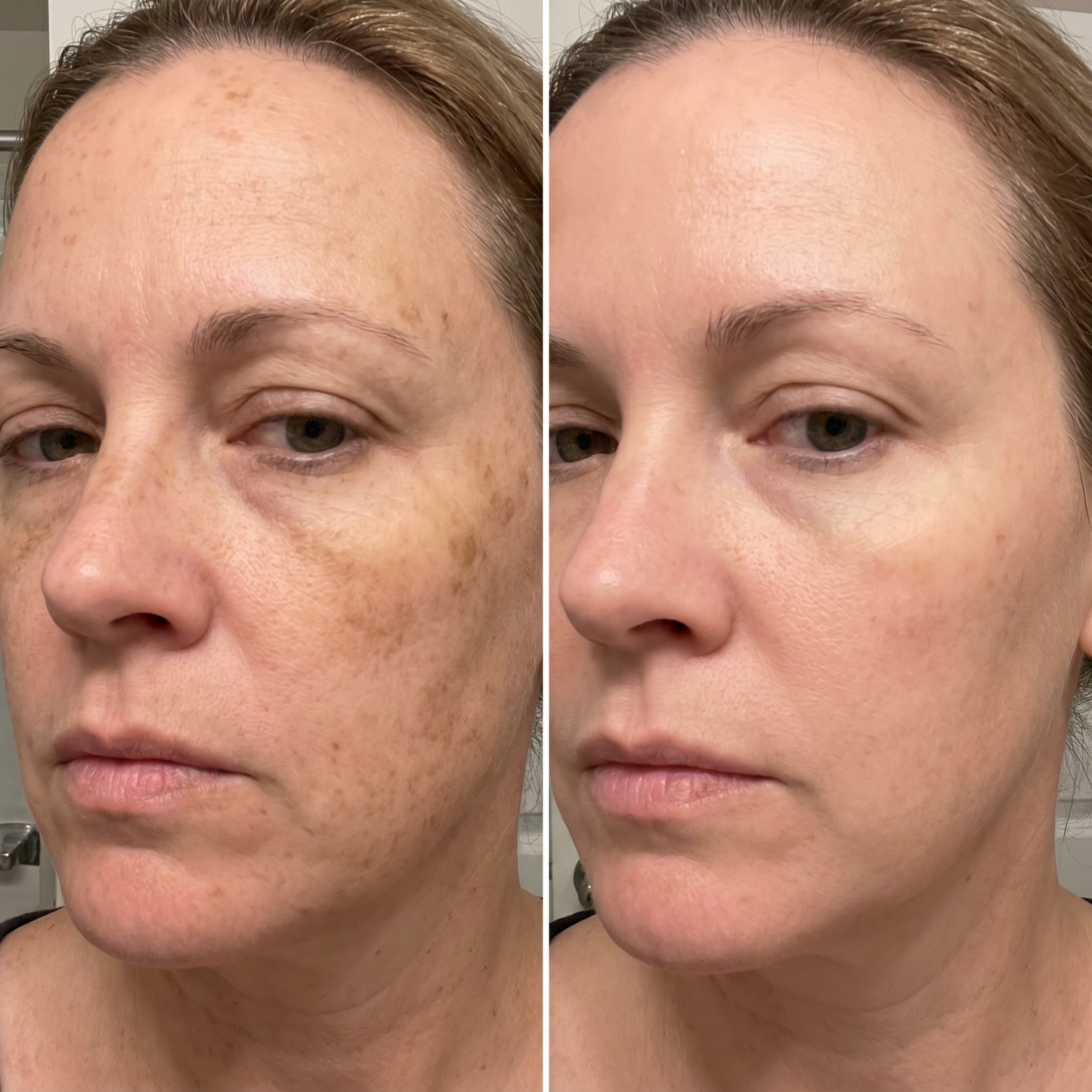 LumiDerm™ Korean Dark Spot Renewal Cream